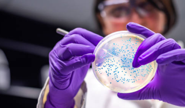 Uji Mikrobiologis & MPN E. coli pada Kemasan Plastik Farmasi: Langkah Penting Menjamin Keamanan Produk